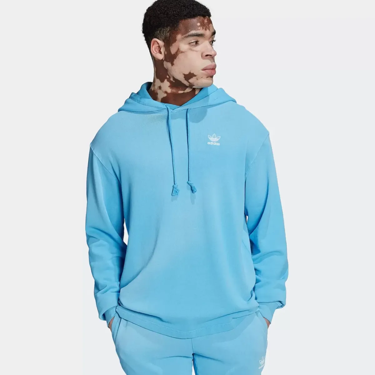 Adidas Originals Hoodies & Crews<Essentials+ Dye Hoodie