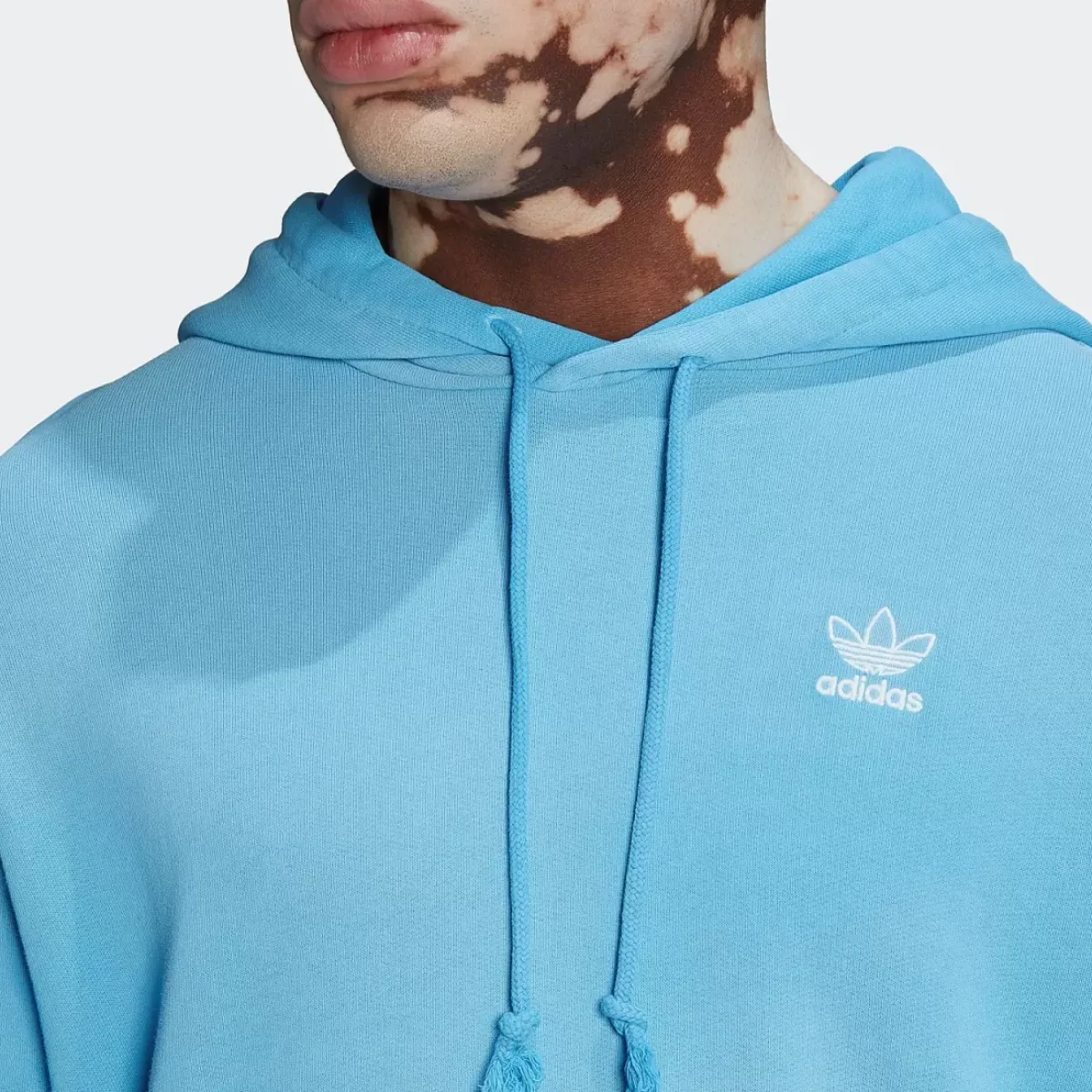 Adidas Originals Hoodies & Crews<Essentials+ Dye Hoodie